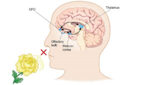 A diagram of the human head with an arrow pointing to it.